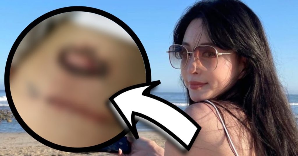 Les fans inondent l’Instagram de l’actrice Han Ye Seul de louanges après que la dernière mise à jour ait capturé la cicatrice d’un horrible incident en 2018.