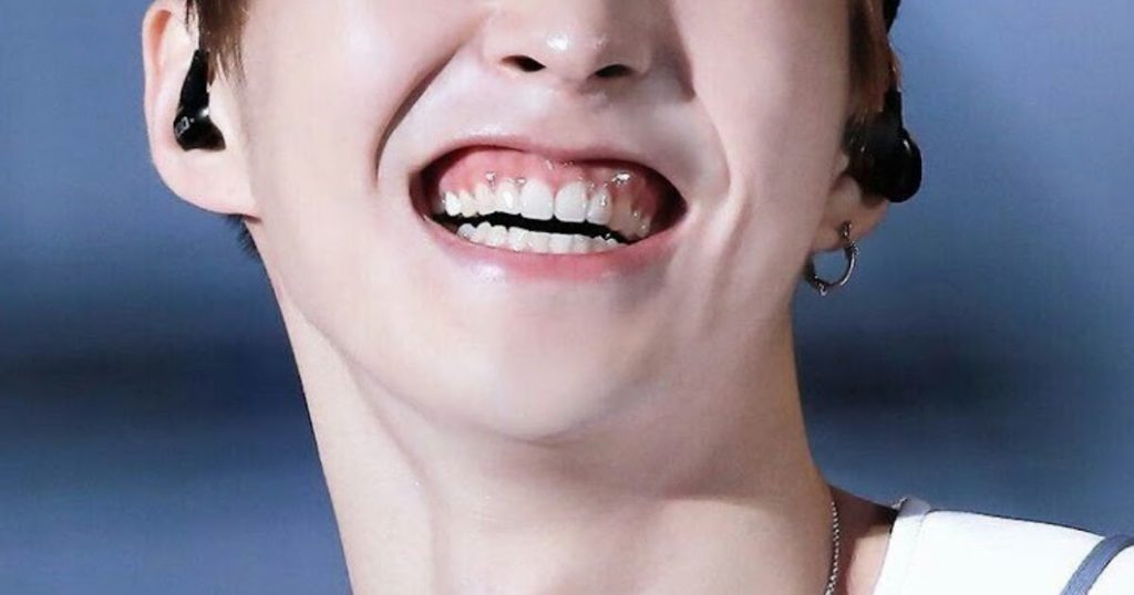 Les fans adorent les sourires gommeux de nombreuses idoles de la K-Pop, mais certains dentistes ne les recommandent pas.