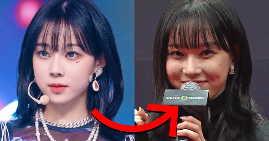 3 idoles féminines de la K-Pop dont les problèmes de peau prouvent qu’elles sont comme nous
