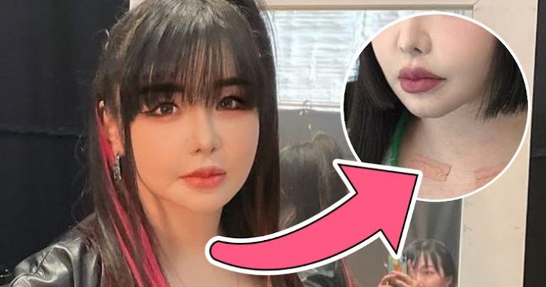 Park Bom’s Representative Addresses Concerns Around The Singer’s Now-Deleted “Transformation” Picture