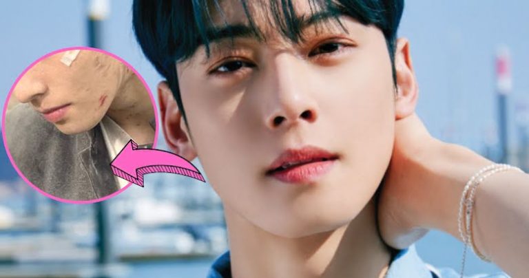 A Single Photo Of A “Bloodied” Cha Eunwoo Has Netizens In Shambles