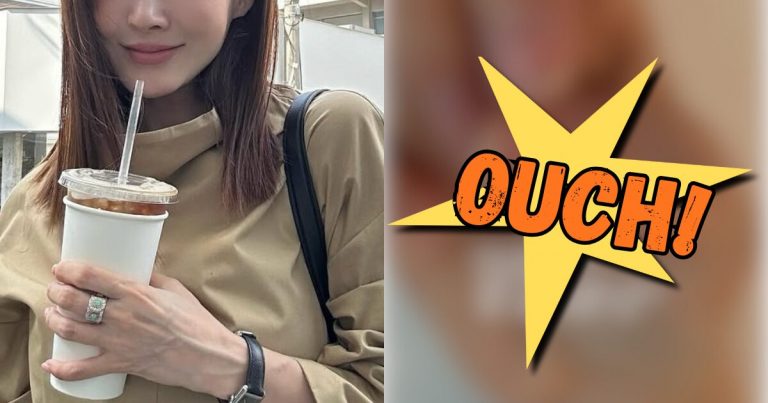 Price Of Being A Female Celebrity?— Popular Singer-Actress Posts Tragic Result Of Extensive Beauty Procedure