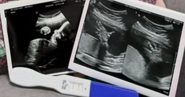 Model-Turned-TV Personality Reveals She’s Expecting Just Two Months Into Marriage